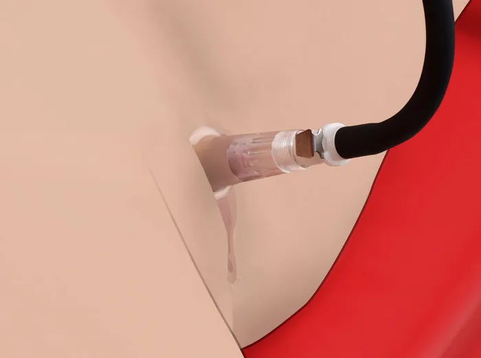 Clitoris Pumping System | Size Matters Vibrators